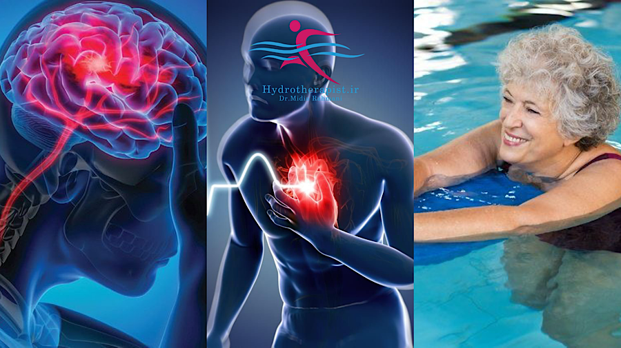 تاثیر آب‌درمانی بر پیشگیری از ابتلا به سکته‌های قلبی و مغزی